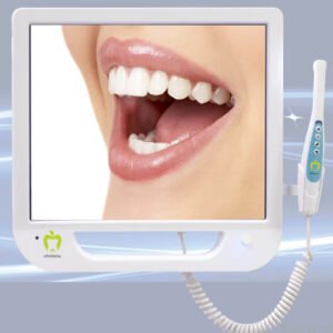 Intra Oral Camera