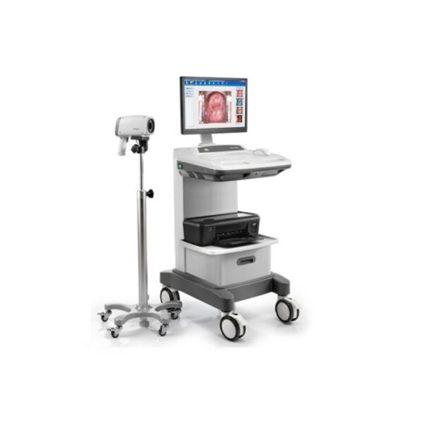 Colposcope